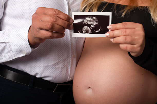 男女手持超声波照片，显示怀孕和胎儿的迹象图片下载