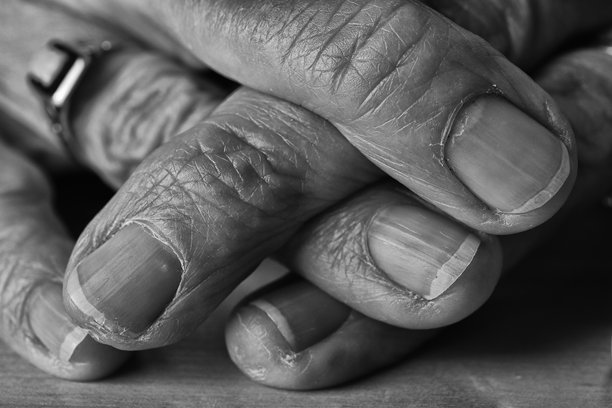 黑白照片中，一位老年女性的纤细手指交叉 resting 在桌子上。图片下载