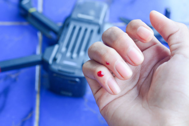 被无人机螺旋桨伤到的手的照片图片下载