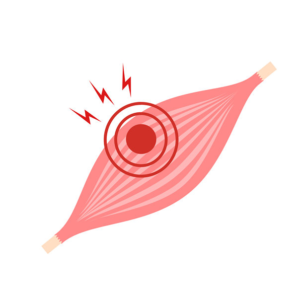 小腿疼痛，腿部后肌肉，血管，神经，急性运动损伤，动脉创伤，网球，足球，撕裂，抽筋，痉挛，腿部抽筋，内侧纤维，淤伤，跑步，走路，肌腱，血栓，深静脉，拉伤，撕裂，扭伤图片下载