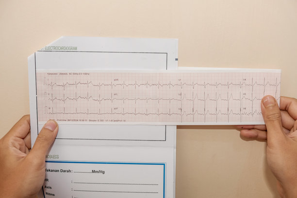 手握纸张上心形图案的照片，记录结果，背景为奶油色。图片下载