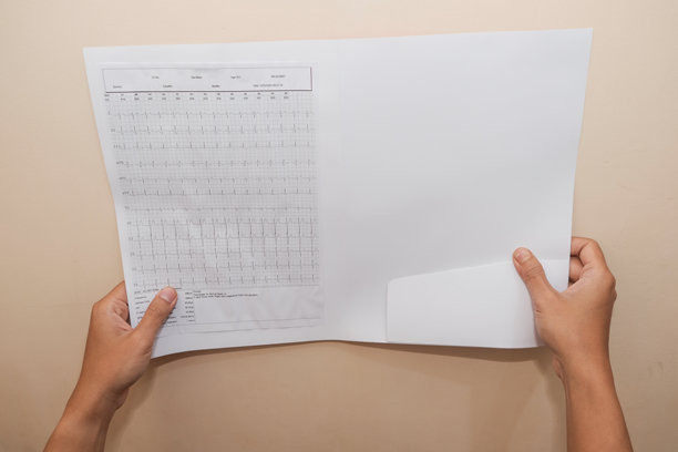 手握纸质心形图案的照片，记录结果，背景为奶油色。图片下载