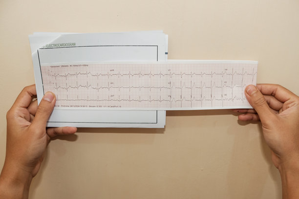 手握纸张上心形图案的照片，记录结果，背景为奶油色。图片下载