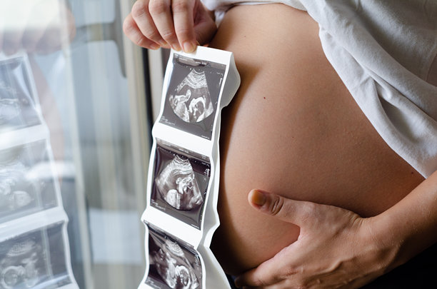 孕妇手持宝宝的超声波图像。孕肚和超声照片的特写。健康怀孕概念图片下载