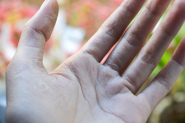 疼痛手指的特写照片图片下载