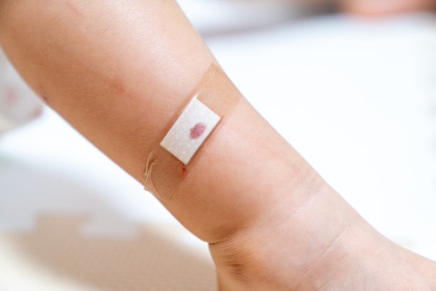 受伤儿童的照片。绷带。图片下载