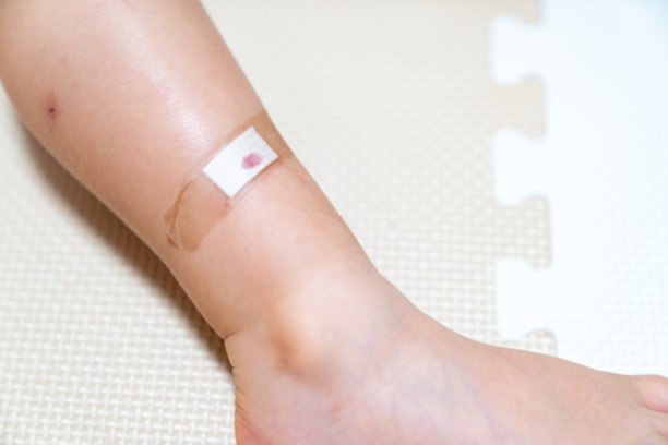 受伤儿童的照片。绷带。图片下载