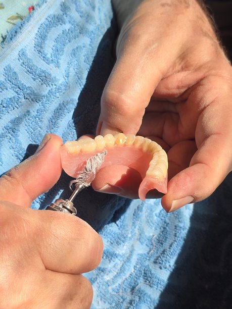 照片显示双手轻柔地握着工具，正在修整假牙，为最终抛光阶段做准备。图片下载