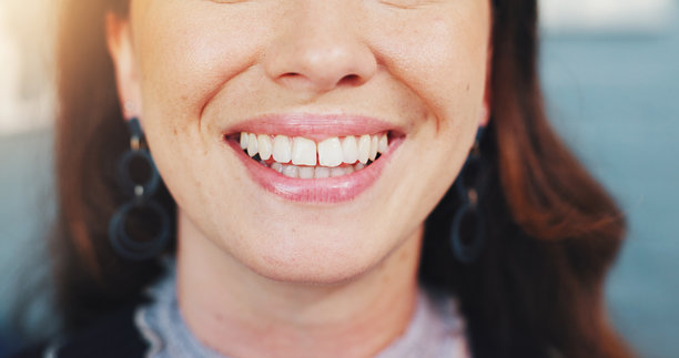 牙齿、嘴巴和女性在牙医处的特写，进行牙齿护理、健康和清新口气。清洁、牙齿美白和快乐的人，关注口腔卫生、正畸和面部美容。图片下载