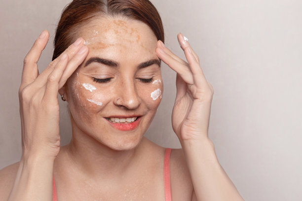 女性使用面霜来对抗色素沉着。含有防紫外线保护的面霜 SPF。面部有色素沉着、黄褐斑、雀斑和老年斑的照片。图片下载