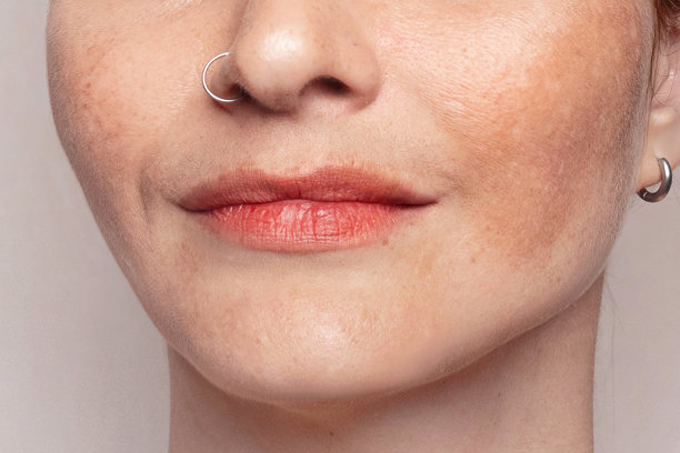 带有色素沉着、黄褐斑、雀斑和老年斑的女性面部特写照片。特写纹理照片。图片下载