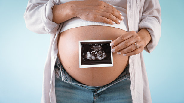 怀孕的女人手持超声波照片图片下载