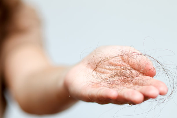 一只女性的手握着一缕掉落的头发。这张照片是脱发的有力象征，非常适合治疗或健康相关主题。图片下载