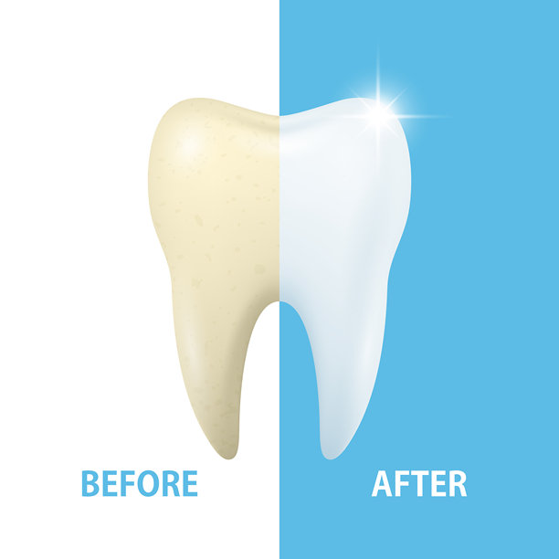 牙齿美白前后。矢量插画。牙齿护理与健康笑容概念。牙齿美容美白，牙釉质清洁，洁白牙齿，口腔卫生，牙科治疗，完美笑容图片下载