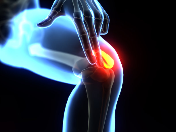 了解膝盖疼痛及其成因，以促进关节健康和活动能力。3D插画图片下载