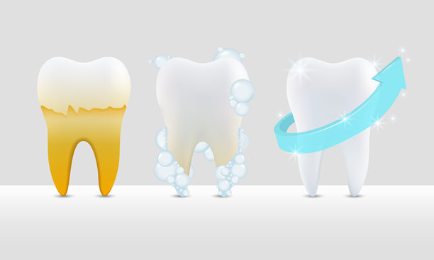 矢量插画。牙齿美白与清洁过程。之前、之中、之后图片下载
