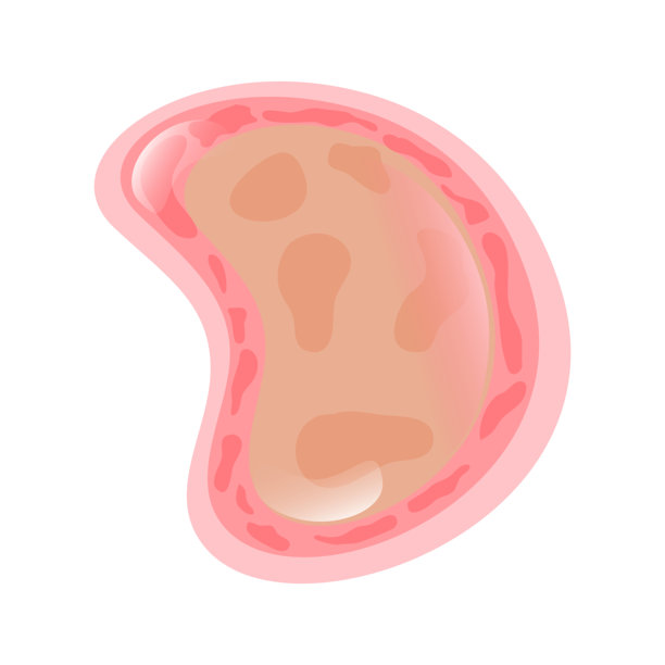 皮肤癣菌病插画，一幅展示人体基本构成元素的数字解剖学素材，用于生物学教育和医学可视化。图片下载