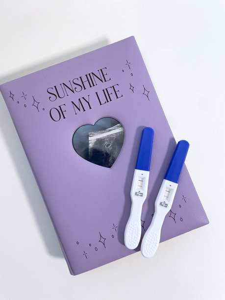 验孕棒和超声波照片以及婴儿日记图片下载