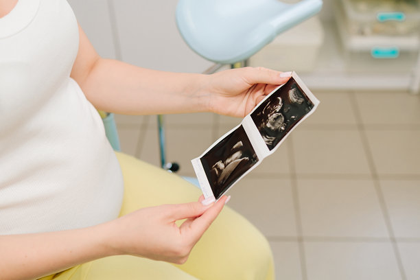 孕妇将宝宝的超声波照片放在腹部上，并注视着它。记录下珍贵的母性时刻，包括 the sonogram。图片下载