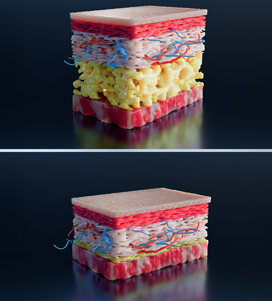 减肥对比。身材变化。胖瘦腰部前后对比，肥胖腹部变苗条，皮肤层解剖，快速减肥过程，皮肤下。脂肪燃烧，3D渲染图片下载