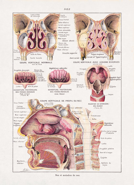 关于鼻子及其疾病的彩色医学插画图片下载