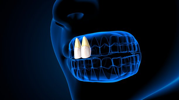 蓝色背景下的牙齿解剖结构与人体骨骼。3D插画。图片下载