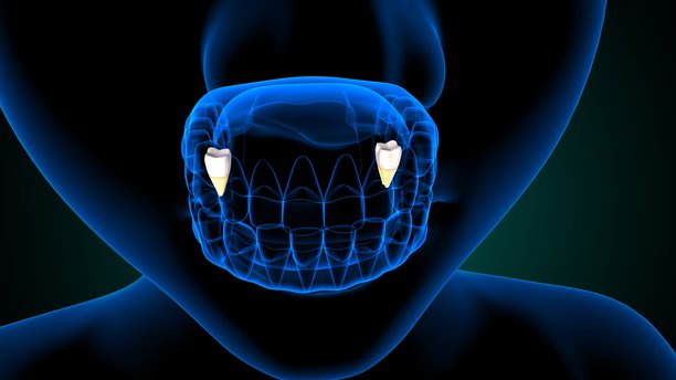 蓝色背景下的人体结构牙齿解剖图。3D插画。图片下载
