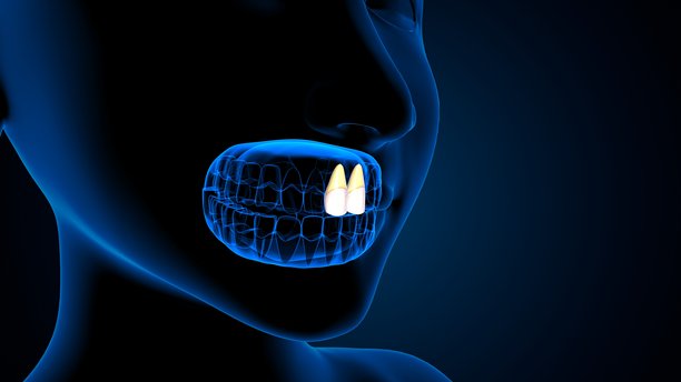 蓝色背景下的牙齿解剖与身体结构。三维插画图片下载