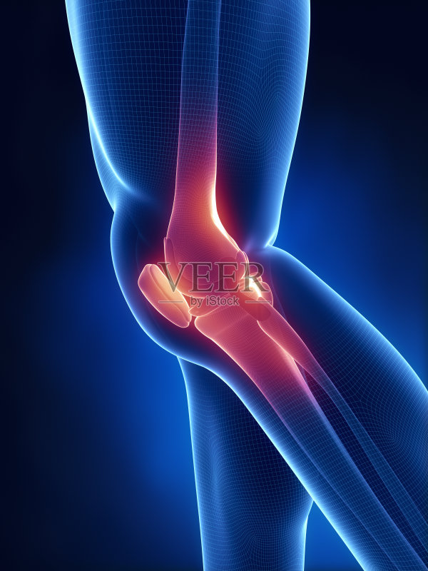 x光片显示膝盖疼痛正版图片素材
