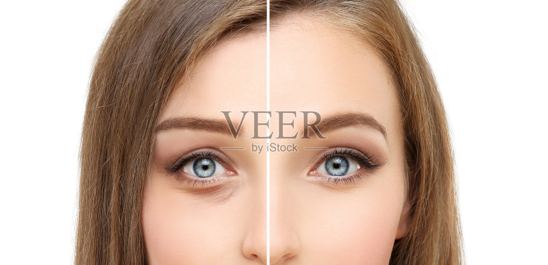 眼睑整容术。正版图片素材